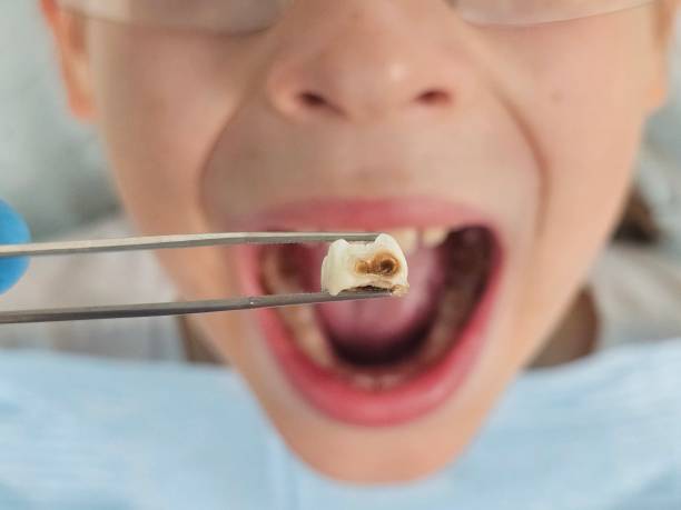 Best Emergency Treatment for Toothache in Carnot Moon, PA