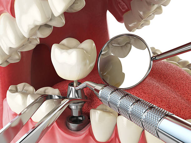Best After-Hours Emergency Dentist in Carnot Moon, PA